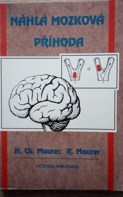 Náhlá mozková příhoda