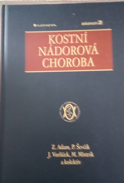 Kostní nádorová choroba